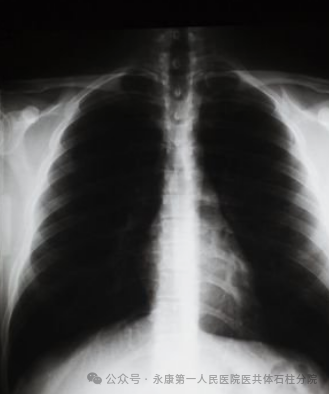 x光是什么原理闻之色变？关于x射线的那些事情——_https://www.jmylbn.com_新闻资讯_第3张
