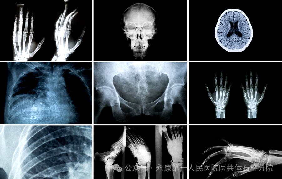 x光是什么原理闻之色变？关于x射线的那些事情——_https://www.jmylbn.com_新闻资讯_第1张
