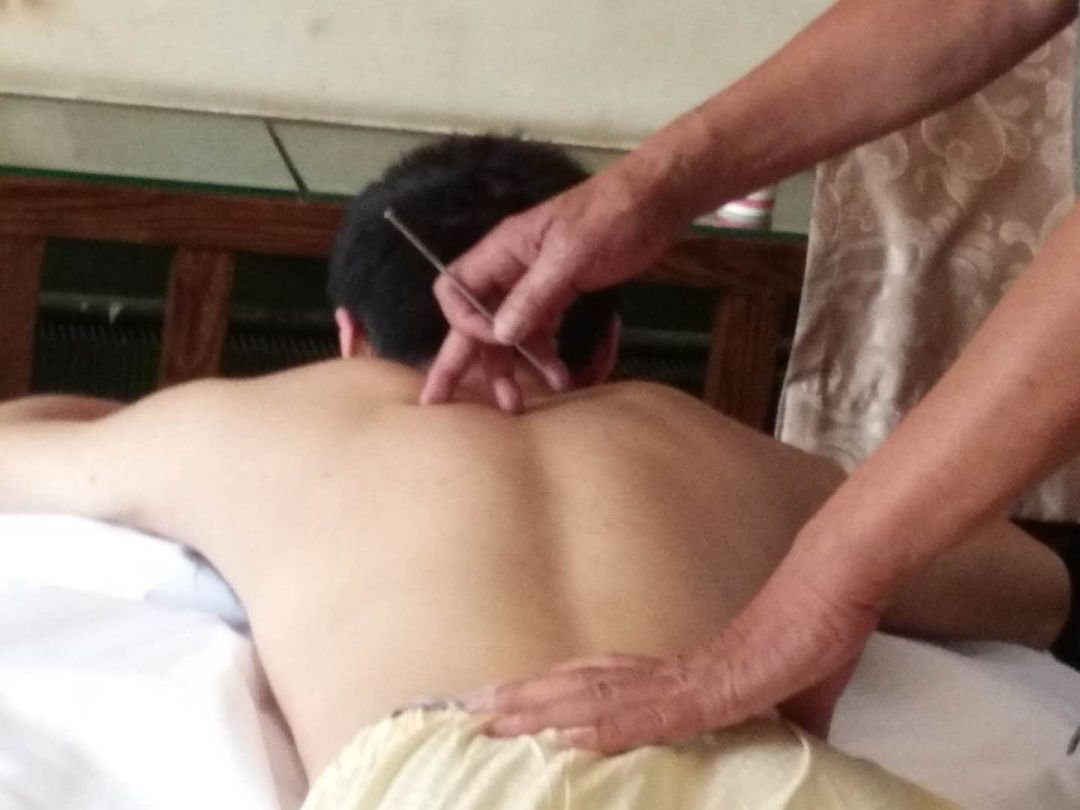 导什么针什么很多中医人都不了解的医学瑰宝，濒临失传的“古九针”之一【鍉针导引疗法】附实操视频_https://www.jmylbn.com_新闻资讯_第4张