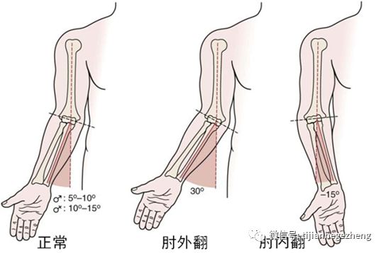 121招飞体检可以接受肘外翻吗 航空人员体检鉴定 微信公众号文章阅读 Wemp