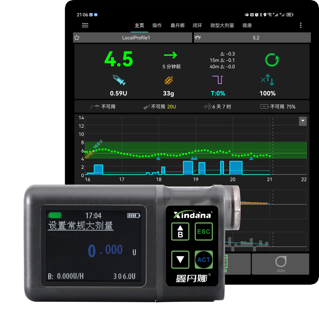 为什么要用泵打针到底要不要买胰岛素泵!？糖尿病人的纠结所在！_https://www.jmylbn.com_新闻资讯_第1张