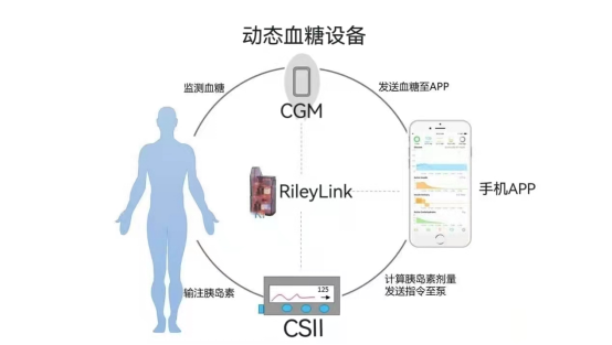 为什么要用泵打针到底要不要买胰岛素泵!？糖尿病人的纠结所在！_https://www.jmylbn.com_新闻资讯_第2张