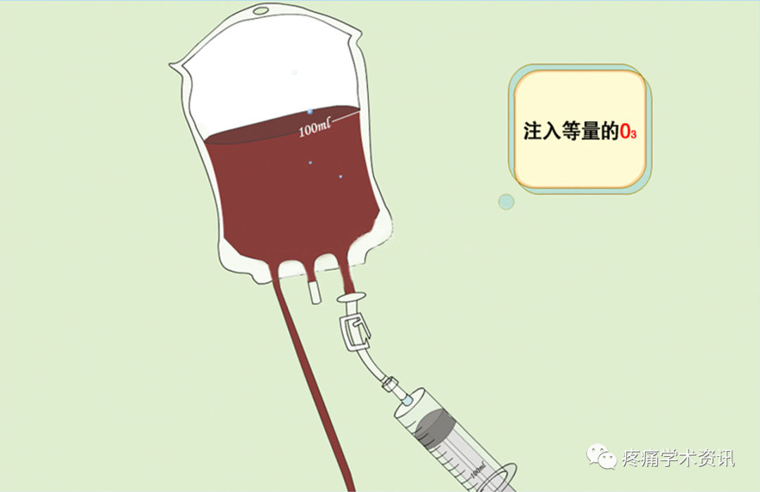 什么是臭氧大自血疗法臭氧大自血治疗好处多，但这些人群最好都别碰_https://www.jmylbn.com_新闻资讯_第3张