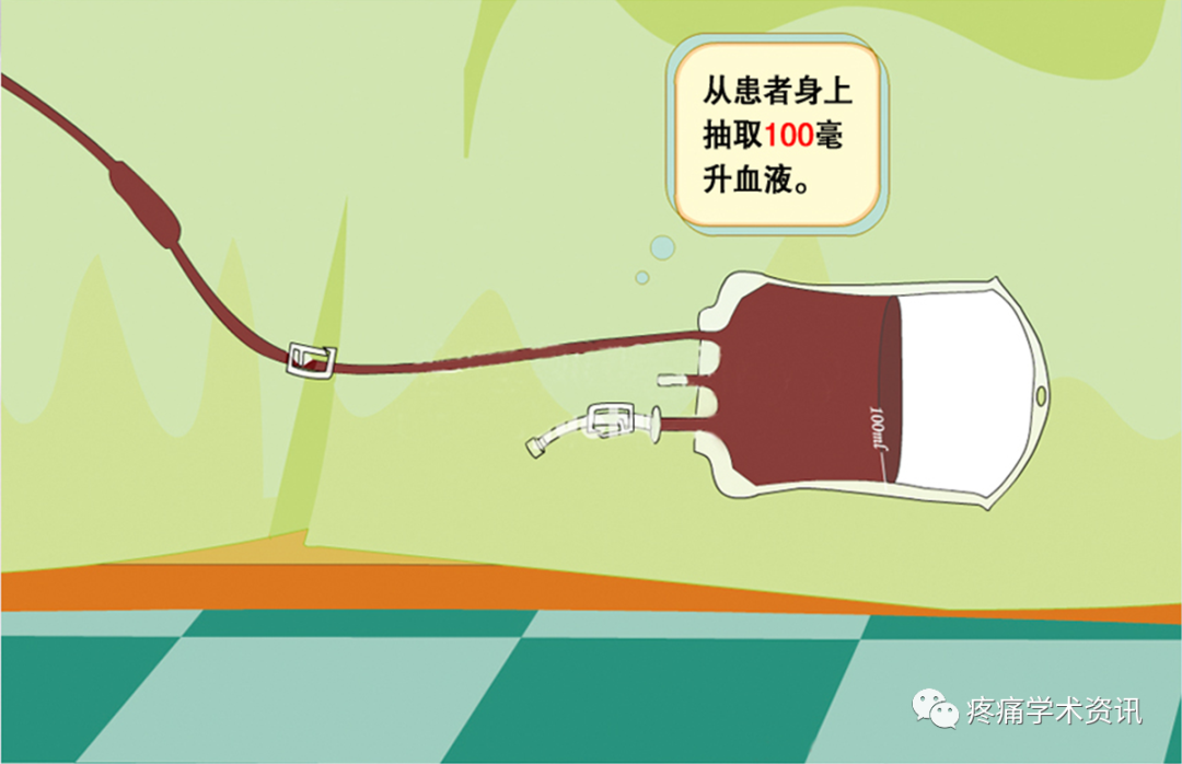 什么是臭氧大自血疗法臭氧大自血治疗好处多，但这些人群最好都别碰_https://www.jmylbn.com_新闻资讯_第2张