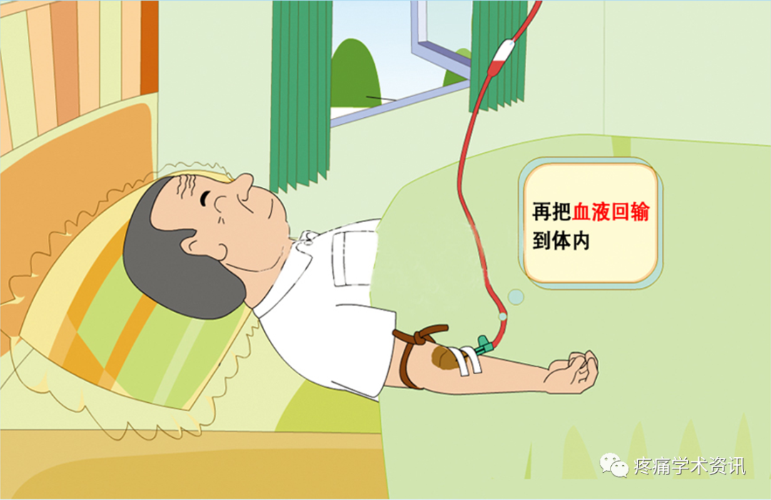 什么是臭氧大自血疗法臭氧大自血治疗好处多，但这些人群最好都别碰_https://www.jmylbn.com_新闻资讯_第5张