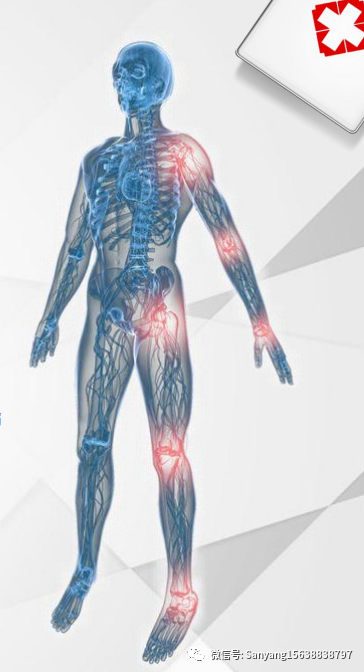 医用红外热像仪怎么开机【红外热成像仪】疼痛康复科的必备“武器”_https://www.jmylbn.com_新闻资讯_第4张