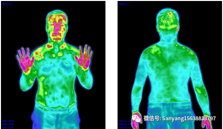 医用红外热像仪怎么开机【红外热成像仪】疼痛康复科的必备“武器”_https://www.jmylbn.com_新闻资讯_第9张