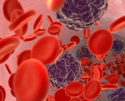 检查采血容器怎么分医学拾萃 ｜ 2019年12月刊：真空采血管对凝血试验的影响_https://www.jmylbn.com_新闻资讯_第3张