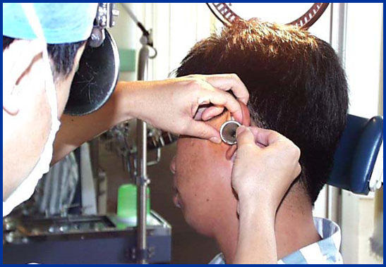 耳鼻喉头灯怎么用几种常用的耳鼻喉科检查方法！_https://www.jmylbn.com_新闻资讯_第20张