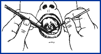 耳鼻喉头灯怎么用几种常用的耳鼻喉科检查方法！_https://www.jmylbn.com_新闻资讯_第14张