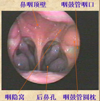 耳鼻喉头灯怎么用几种常用的耳鼻喉科检查方法！_https://www.jmylbn.com_新闻资讯_第28张