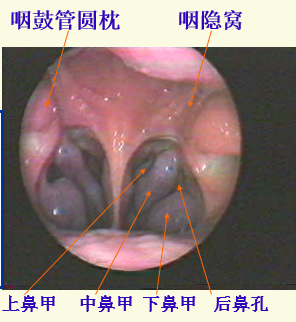 耳鼻喉头灯怎么用实用干货！耳鼻咽喉的检查方法，你都掌握了吗？_https://www.jmylbn.com_新闻资讯_第16张