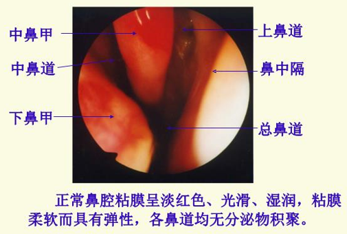 耳鼻喉头灯怎么用几种常用的耳鼻喉科检查方法！_https://www.jmylbn.com_新闻资讯_第12张