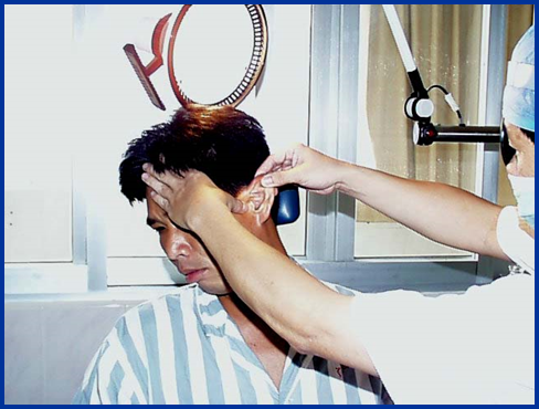 耳鼻喉头灯怎么用几种常用的耳鼻喉科检查方法！_https://www.jmylbn.com_新闻资讯_第18张