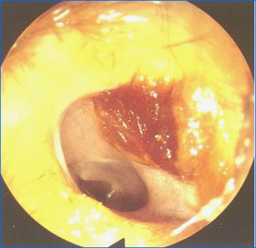 耳鼻喉头灯怎么用实用干货！耳鼻咽喉的检查方法，你都掌握了吗？_https://www.jmylbn.com_新闻资讯_第20张