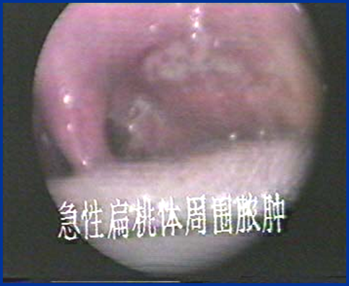 耳鼻喉头灯怎么用实用干货！耳鼻咽喉的检查方法，你都掌握了吗？_https://www.jmylbn.com_新闻资讯_第25张