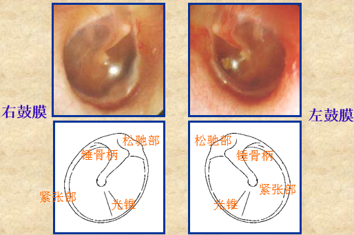 耳鼻喉头灯怎么用几种常用的耳鼻喉科检查方法！_https://www.jmylbn.com_新闻资讯_第22张