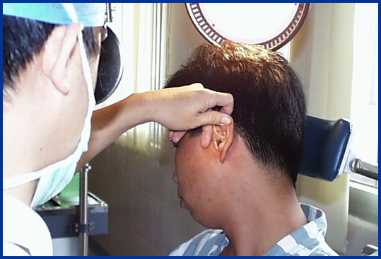 耳鼻喉头灯怎么用几种常用的耳鼻喉科检查方法！_https://www.jmylbn.com_新闻资讯_第19张