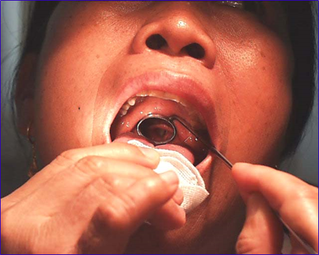 耳鼻喉头灯怎么用实用干货！耳鼻咽喉的检查方法，你都掌握了吗？_https://www.jmylbn.com_新闻资讯_第29张