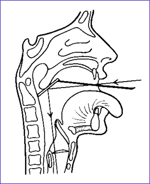 耳鼻喉头灯怎么用实用干货！耳鼻咽喉的检查方法，你都掌握了吗？_https://www.jmylbn.com_新闻资讯_第28张