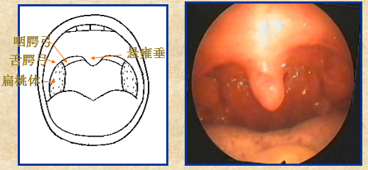 耳鼻喉头灯怎么用几种常用的耳鼻喉科检查方法！_https://www.jmylbn.com_新闻资讯_第24张
