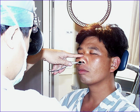 耳鼻喉头灯怎么用几种常用的耳鼻喉科检查方法！_https://www.jmylbn.com_新闻资讯_第9张