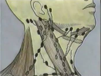 手术室体位垫怎么用手术精讲：图文详解甲状腺手术（含腔镜下手术）_https://www.jmylbn.com_新闻资讯_第9张