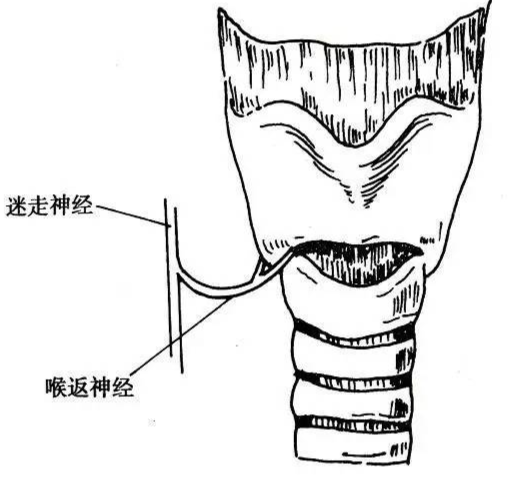 手术室体位垫怎么用手术精讲：图文详解甲状腺手术（含腔镜下手术）_https://www.jmylbn.com_新闻资讯_第18张