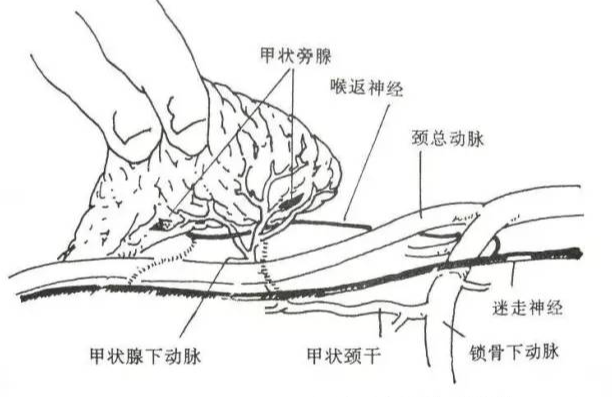 手术室体位垫怎么用手术精讲：图文详解甲状腺手术（含腔镜下手术）_https://www.jmylbn.com_新闻资讯_第16张