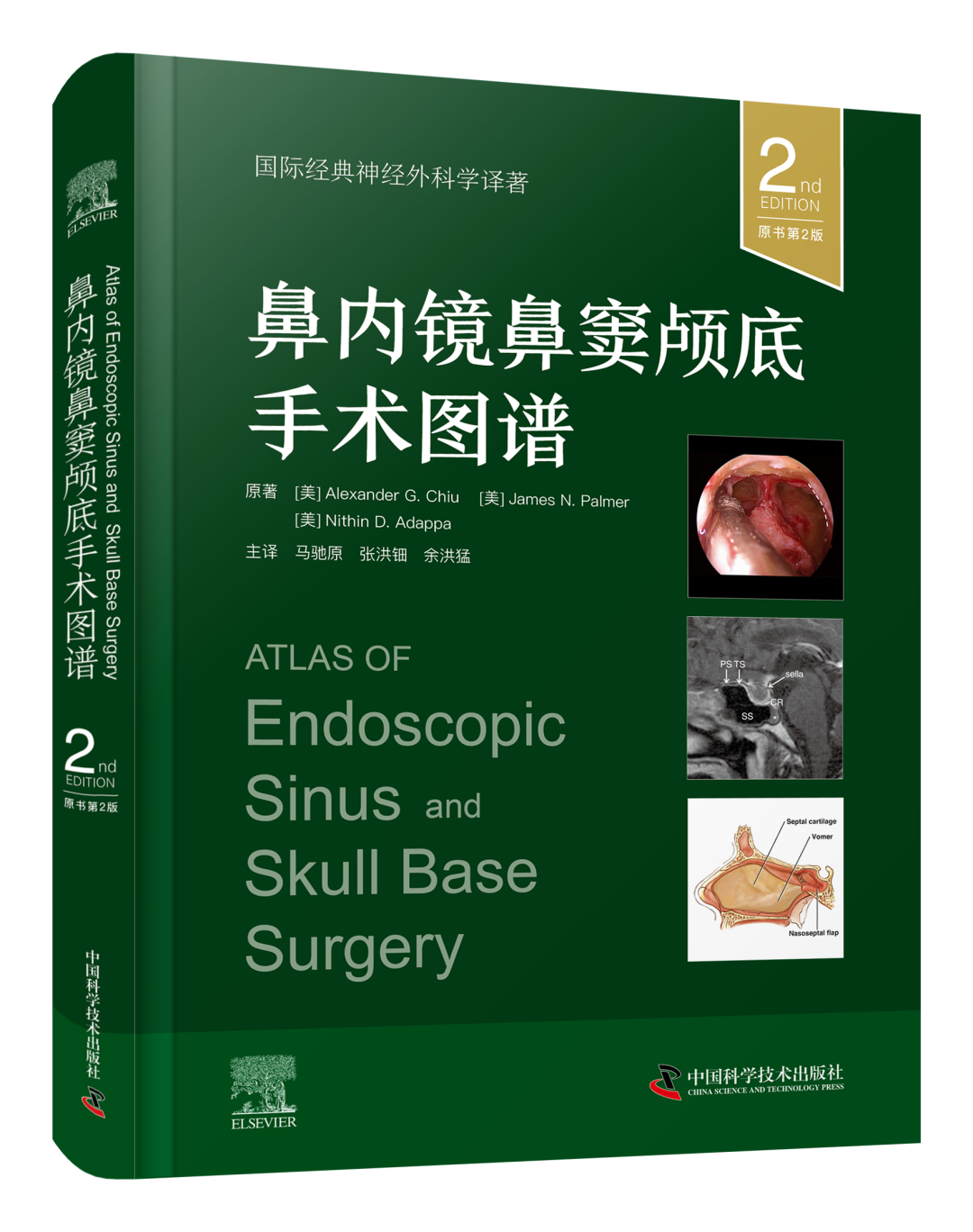 操作鼻窦镜时怎么摆经鼻内镜开展鼻窦颅底手术的具体步骤及操作图谱_https://www.jmylbn.com_新闻资讯_第2张