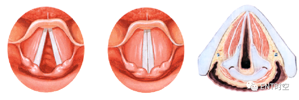 为什么购买可视硬性喉镜临床常见喉镜的分类及使用_https://www.jmylbn.com_新闻资讯_第7张