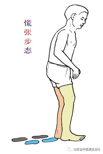 步态分析上曲线怎么解读康复医学中的步态分析_https://www.jmylbn.com_新闻资讯_第6张