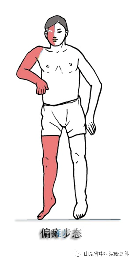 步态分析上曲线怎么解读康复医学中的步态分析_https://www.jmylbn.com_新闻资讯_第5张
