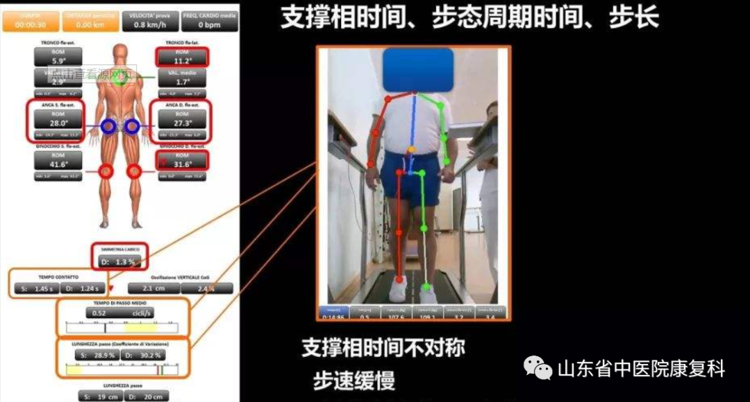 步态分析上曲线怎么解读康复医学中的步态分析_https://www.jmylbn.com_新闻资讯_第8张