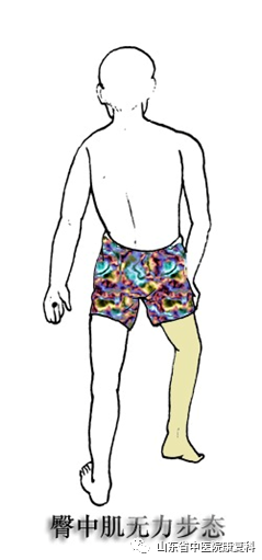 步态分析上曲线怎么解读康复医学中的步态分析_https://www.jmylbn.com_新闻资讯_第4张
