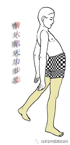 步态分析上曲线怎么解读康复医学中的步态分析_https://www.jmylbn.com_新闻资讯_第3张