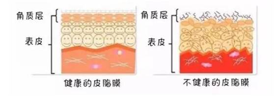 皮脂膜可是皮肤锁水最重要的一层，就像手机膜一样，起到保护和锁水作用。