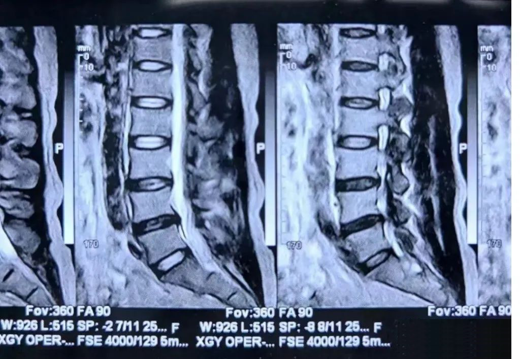 射频什么科【图文解析】疼痛科常用的射频治疗是什么疗法？可以治疗什么疾病？_https://www.jmylbn.com_新闻资讯_第19张