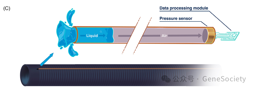 输尿管鞘是什么CTD期刊 ｜ 新突破！实时监测肾内压，新型输尿管鞘让肾结石手术更高效、更安全_https://www.jmylbn.com_新闻资讯_第6张