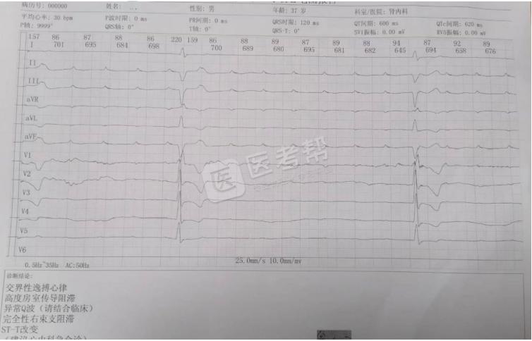 Med怎么电写今年技能基地考试有这些变化，技能考试心电图部分知识点你都会吗？_https://www.jmylbn.com_新闻资讯_第13张