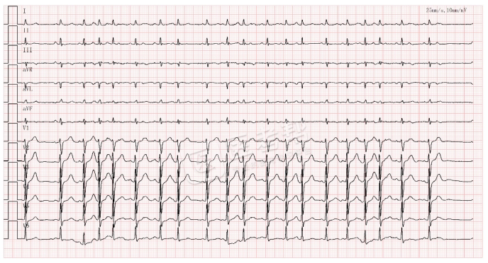Med怎么电写今年技能基地考试有这些变化，技能考试心电图部分知识点你都会吗？_https://www.jmylbn.com_新闻资讯_第5张
