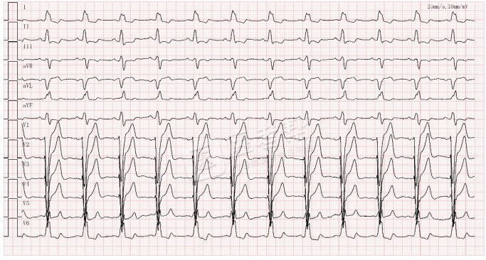 Med怎么电写今年技能基地考试有这些变化，技能考试心电图部分知识点你都会吗？_https://www.jmylbn.com_新闻资讯_第15张