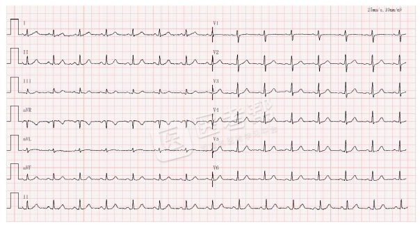 Med怎么电写今年技能基地考试有这些变化，技能考试心电图部分知识点你都会吗？_https://www.jmylbn.com_新闻资讯_第1张