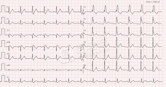 Med怎么电写今年技能基地考试有这些变化，技能考试心电图部分知识点你都会吗？_https://www.jmylbn.com_新闻资讯_第14张