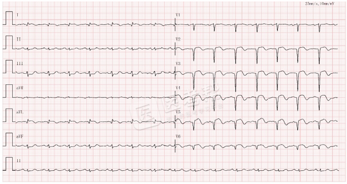Med怎么电写今年技能基地考试有这些变化，技能考试心电图部分知识点你都会吗？_https://www.jmylbn.com_新闻资讯_第18张