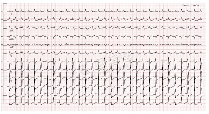 Med怎么电写今年技能基地考试有这些变化，技能考试心电图部分知识点你都会吗？_https://www.jmylbn.com_新闻资讯_第6张
