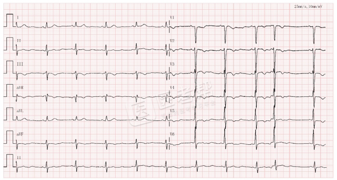 Med怎么电写今年技能基地考试有这些变化，技能考试心电图部分知识点你都会吗？_https://www.jmylbn.com_新闻资讯_第4张