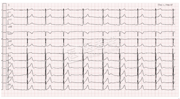Med怎么电写今年技能基地考试有这些变化，技能考试心电图部分知识点你都会吗？_https://www.jmylbn.com_新闻资讯_第10张