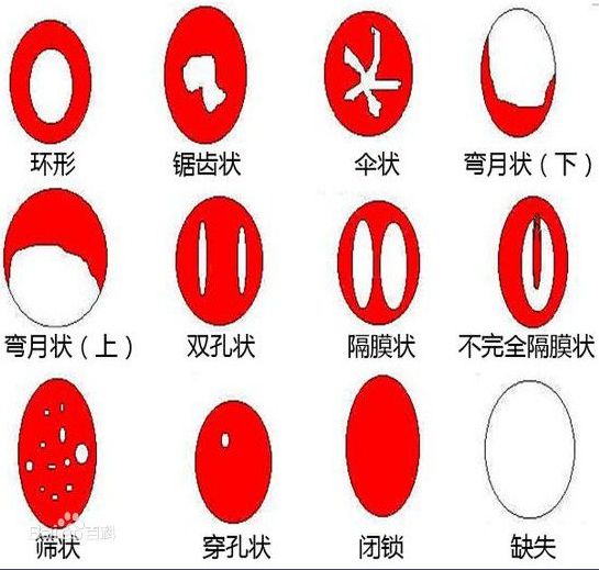 千万不要跟非处女结婚