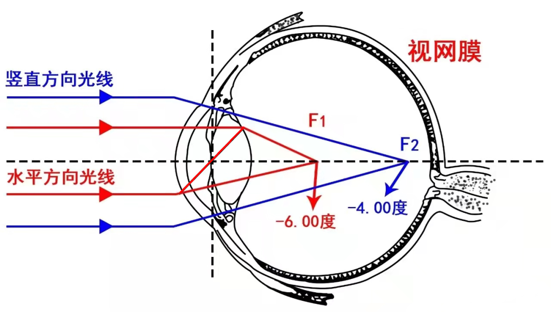 怎么测角膜直径【计量知识】“全国爱眼日” ：关注用眼健康_https://www.jmylbn.com_新闻资讯_第5张